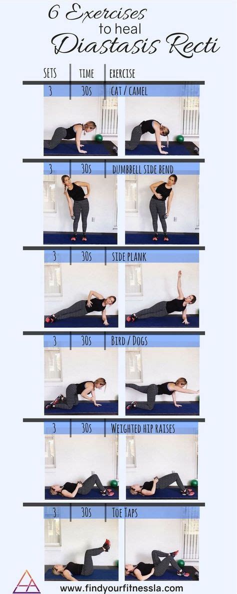 Rectus Diastasis Exercises to Rebuild Your Core After Diastasis Recti ...