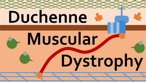 Duchenne Muscular Dystrophy and Dystrophin - YouTube