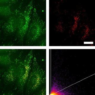 Co-staining experiment of HeLa cells with 1M and LysoTracker Red. The ...