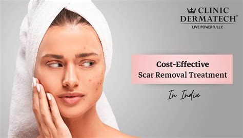 Cost-Effective Acne Scar Removal Treatment In India