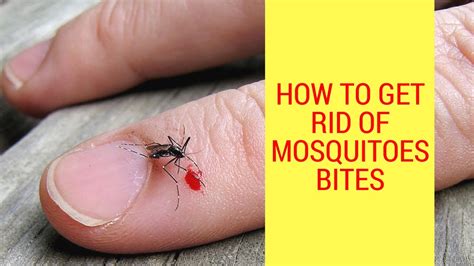 How to Get Rid of Mosquitoes Bites | Treating Mosquito Bites With Home Remedies - YouTube