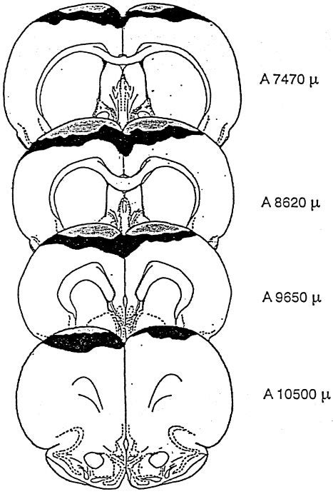 Maximal and minimal extents of frontal cortex lesions. | Download ...