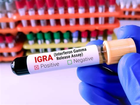 Premium Photo | Blood sample for igra interferon gamma release assay test