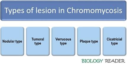 What is Chromomycosis? Causative agent, Symptoms & Treatment - Biology Reader