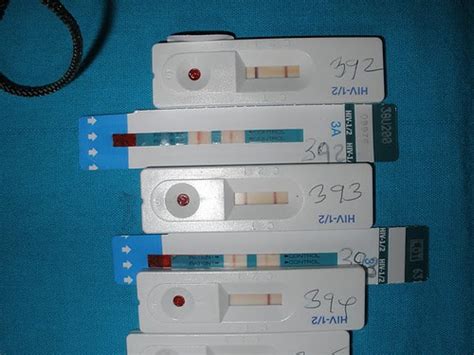 HIV test kits display their results. 392 and 393 are posit… | Flickr