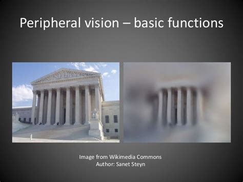 Management of peripheral vision loss