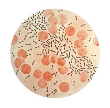 Streptococcus Pneumoniae in China - microbewiki