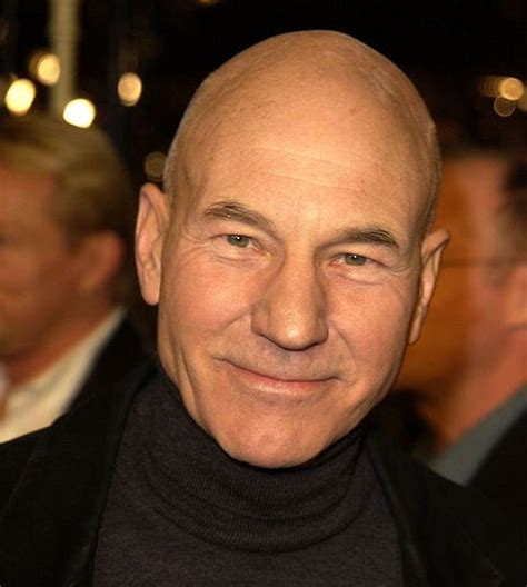 35 Photos of Bald Celebrities When They Had Hair – Bald Actors