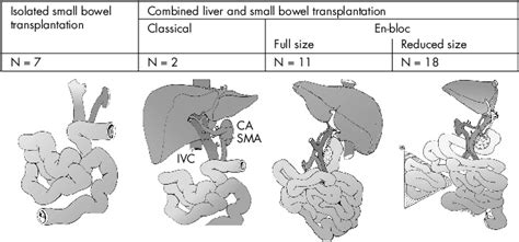 The different types of intestinal transplantation performed at ...