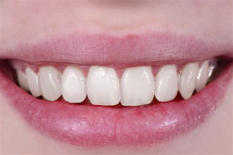 How to Whiten Teeth in Photoshop - PHLEARN