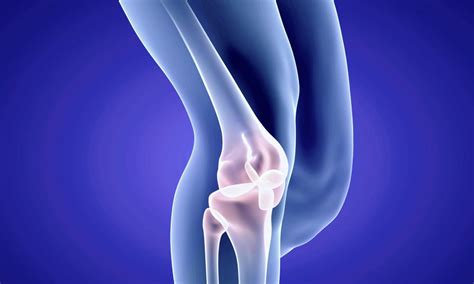 Chondroplasty | Knee Cartilage Replacement