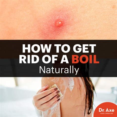 Hot to Get Rid of a Boil & How to Prevent Boils - Dr. Axe