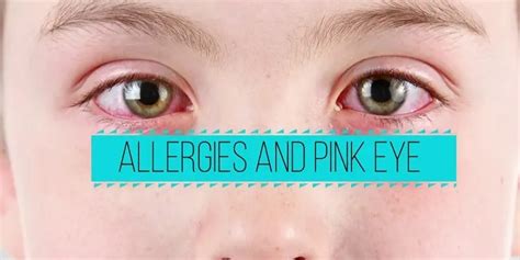 Pink eye symptoms: Discover how to recognize them properly and get quick and adequate help!