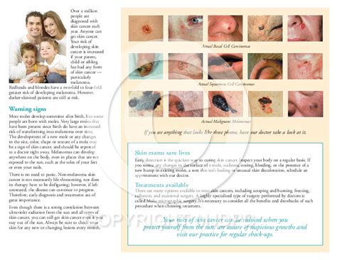 Skin Cancer - Brochure: MJD Patient Communications