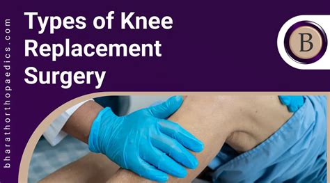 Types of Knee Replacement Surgery | 100% Best Treatment