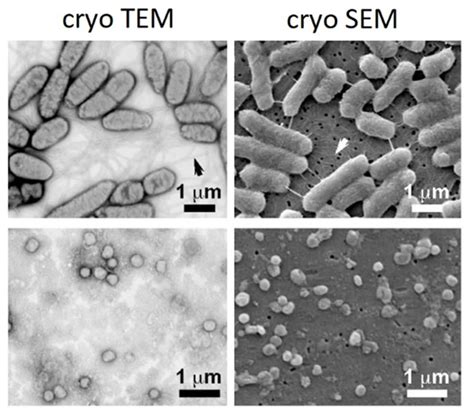 Cryo Electron Microscopy: Principle, Strengths, Limitations and Applications | Technology Networks