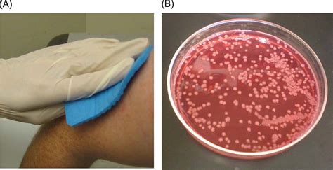 Acinetobacter Infection | India| PDF | PPT| Case Reports | Symptoms ...