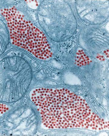 Equine Encephalomyelitis