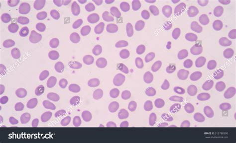 Ovalocytes/elliptocytes are oval or… Stock Photo 313788590 - Avopix.com