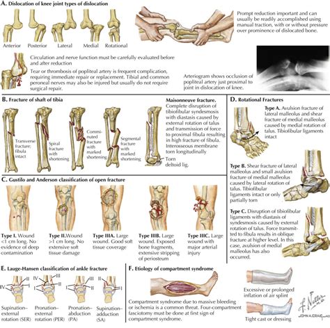 Acute Fractures and Dislocations in Athletes | Musculoskeletal Key