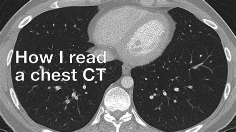 How I Read a Chest CT - YouTube