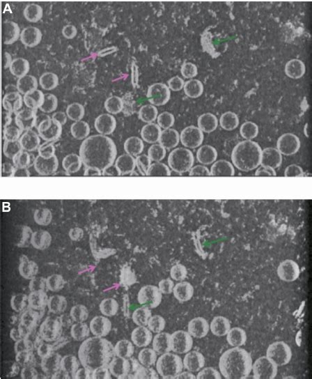 Cryo-TEM tomography. Views at different angles of the same rendered... | Download Scientific Diagram