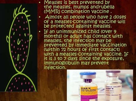 Measles- prevention