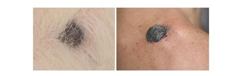 Melanoma In Dogs