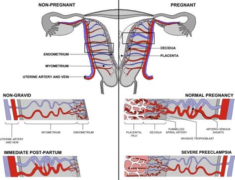 ANAT2341 Lab 4 - Decidua and Cord - Embryology | Placental, Arteries ...