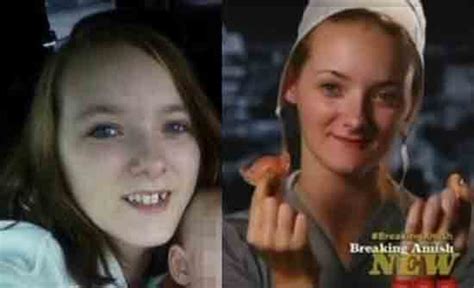 Breaking Amish mystery: Why did Rebecca lose all her teeth at 19? – Starcasm