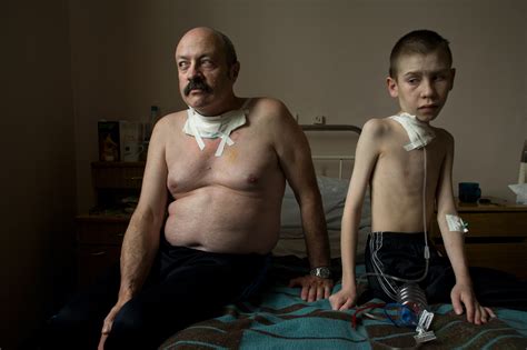 Chernobyl: Health Effects & Birth Defects | SiOWfa14 Science in Our World: Certainty and Cont