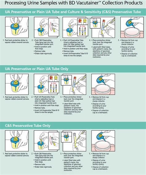 Printable Clean Catch Urine Poster