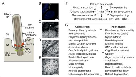 Overview of cilium structure, function and disease associations. (A ...