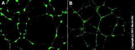 Angiogenesis Assay Kit (In Vitro) (ab204726) | Abcam