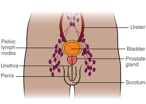 Unexplained Lymphadenopathy: Evaluation And Differential, 46% OFF