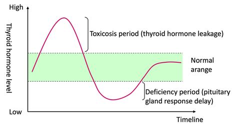 Subacute Thyroiditis