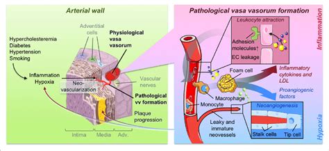 | Pathological vasa vasorum formation and its contribution to plaque ...