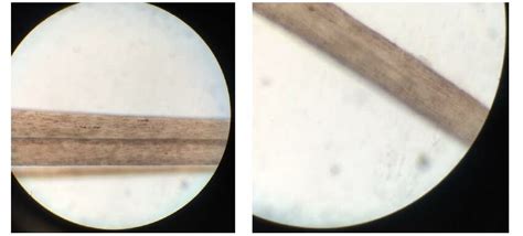 Accumulation of melanosomes was observed in hair shafts which confirmed... | Download Scientific ...