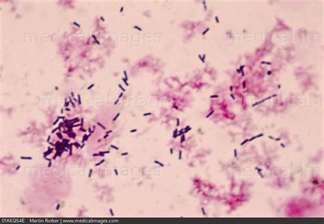 STOCK IMAGE, photomicrograph of lactobacillus sp a gram-positive non-spore-forming rod bacterium ...