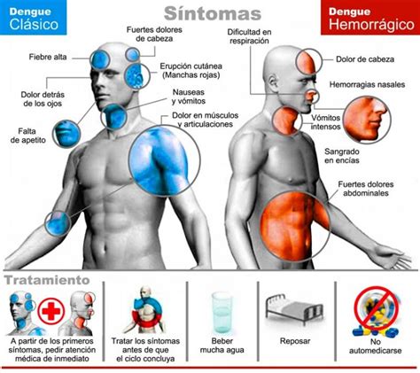 Información sobre los síntomas del dengue