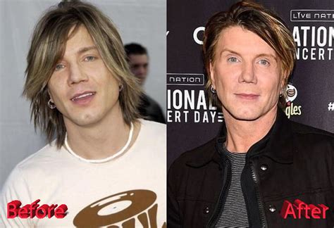 John Rzeznik Plastic Surgery: Was It A Win Or Fail?