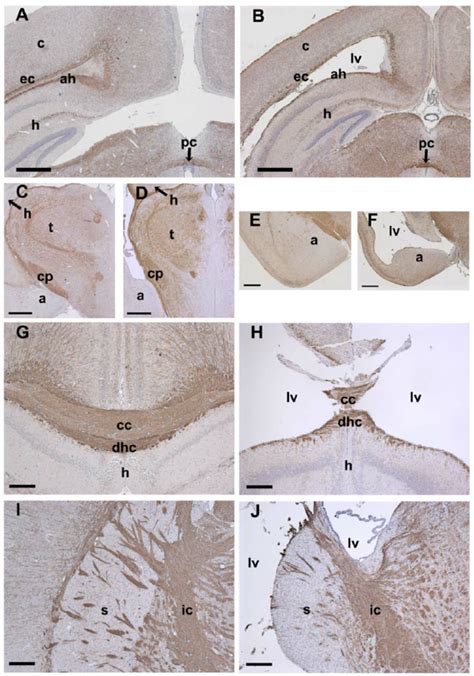 Myelination patterns suggest largely normal late development but with... | Download Scientific ...