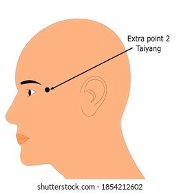 Acupuncture Point That Known Taiyang Extraordinary Stock Vector ...