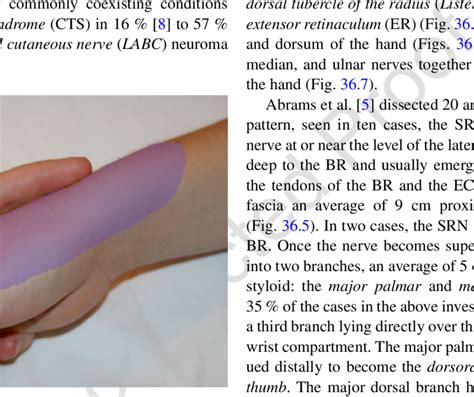 2 Pain pattern associated with superficial radial nerve entrapment ...