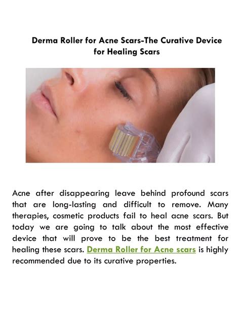 PPT - Derma Roller for Acne Scars-The Curative Device for Healing Scars PowerPoint Presentation ...