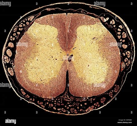 Spinal Cord Cross Section Histology - vrogue.co