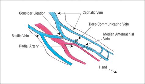 Superficial Veins of Forearm : Mnemonic | Epomedicine