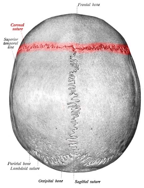 Anatomy, Head and Neck, Coronal Suture Article