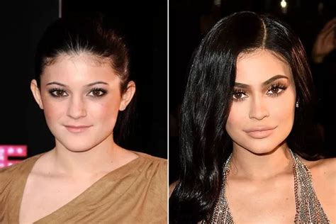 Kylie Jenner - the changing face of the youngest Kardashian... from lip ...