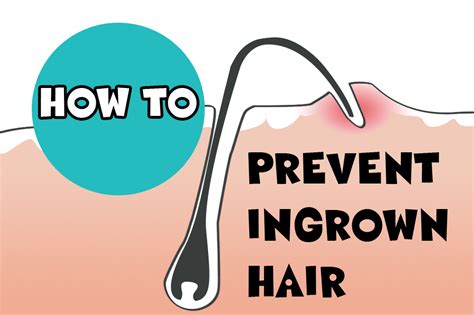 Ingrown Hair Prevention - Modern Design Ideas - Human Hair Exim